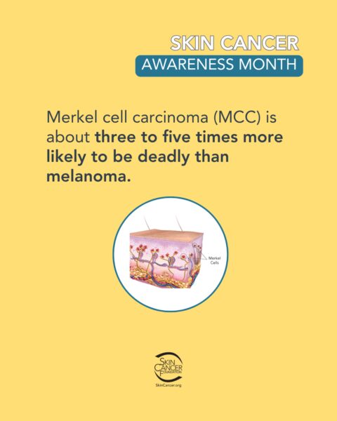 Informational image about Merkel cell carcinoma (MCC), stating it is about three to five times more likely to be deadly than melanoma, accompanied by a diagram of Merkel cells in the skin. The image is promoting Skin Cancer Awareness Month and features the Skin Cancer Foundation logo.