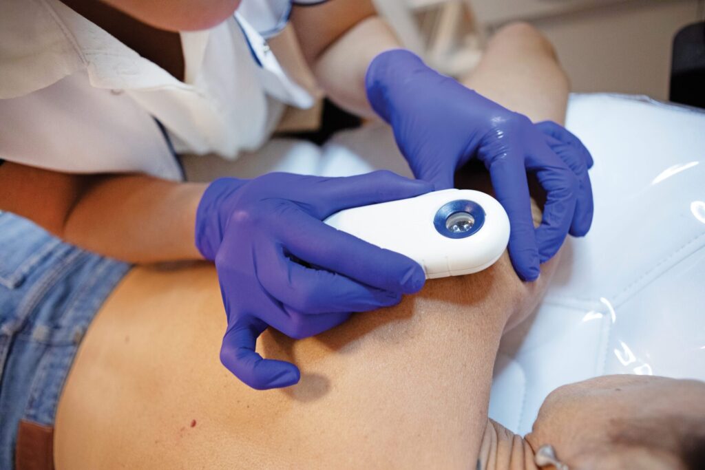 A healthcare provider wearing blue gloves uses a medical device to examine a patient's skin.